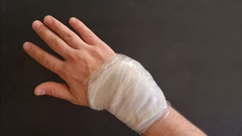 Tapal dengan daun loy dan kubis, foto 7