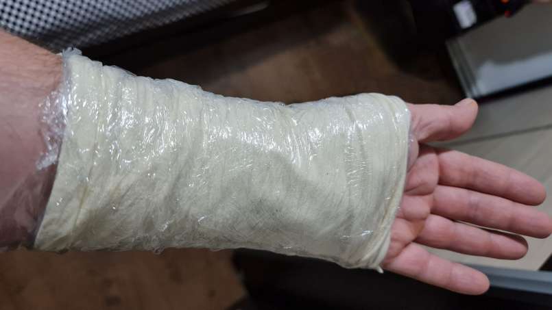 Tapal dengan daun loy dan kubis, foto 8